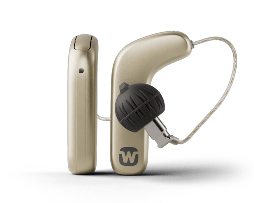 Widex_SmartRIC